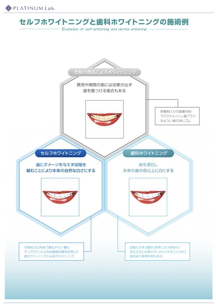 セルフホワイトニングと歯科ホワイトニングの比較